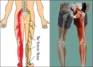 Sciatic Nerve