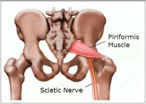 piriformis